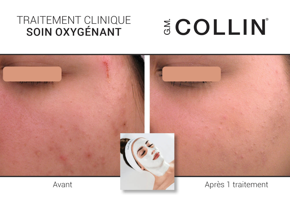 Soin Oxygénant D-Tox - G.M. Collin