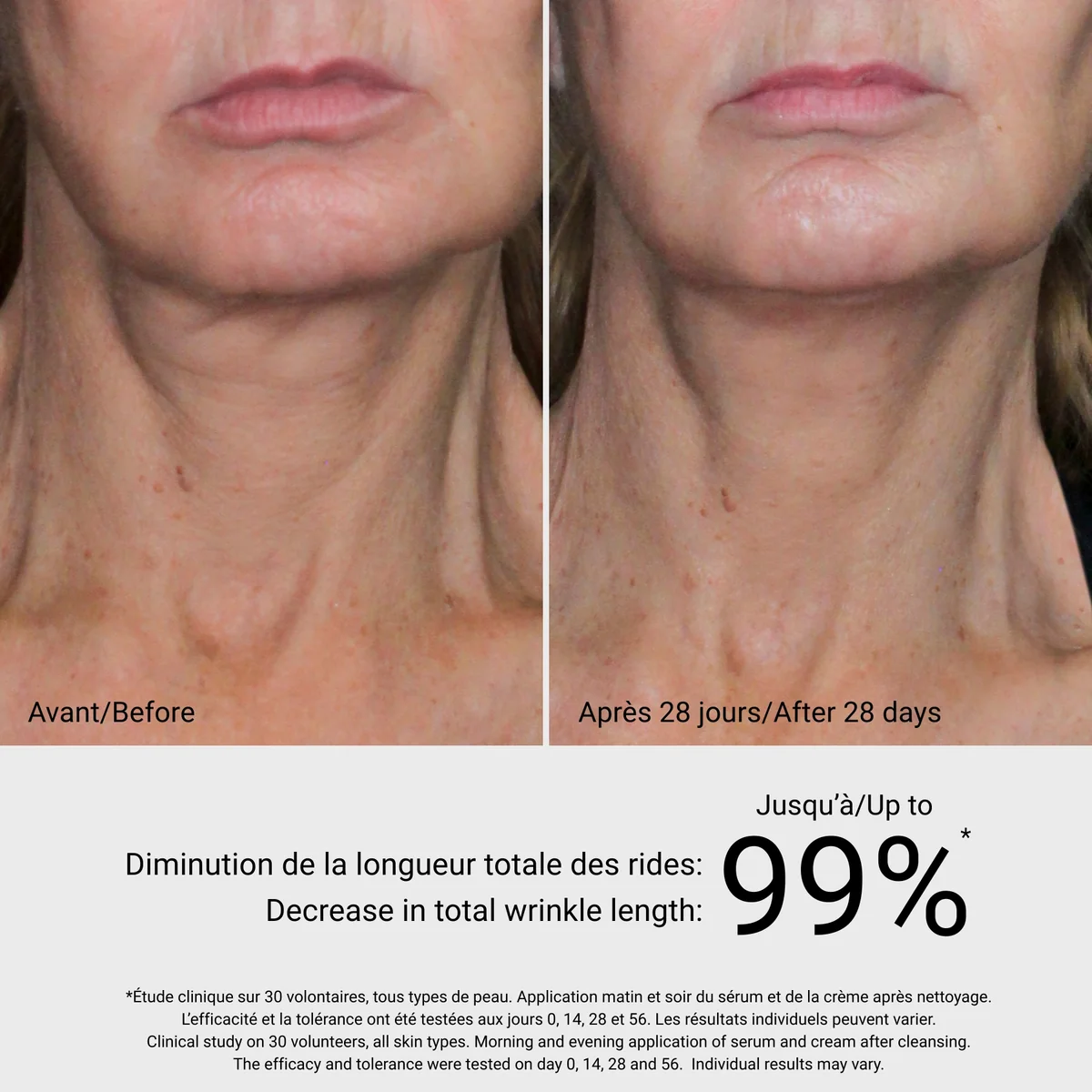 4D Visible Lifting Crème G.M. Collin - résultat avant après 28 jours, jusqu’à 99% diminution rides cou - Spa Santé Le Nénuphar