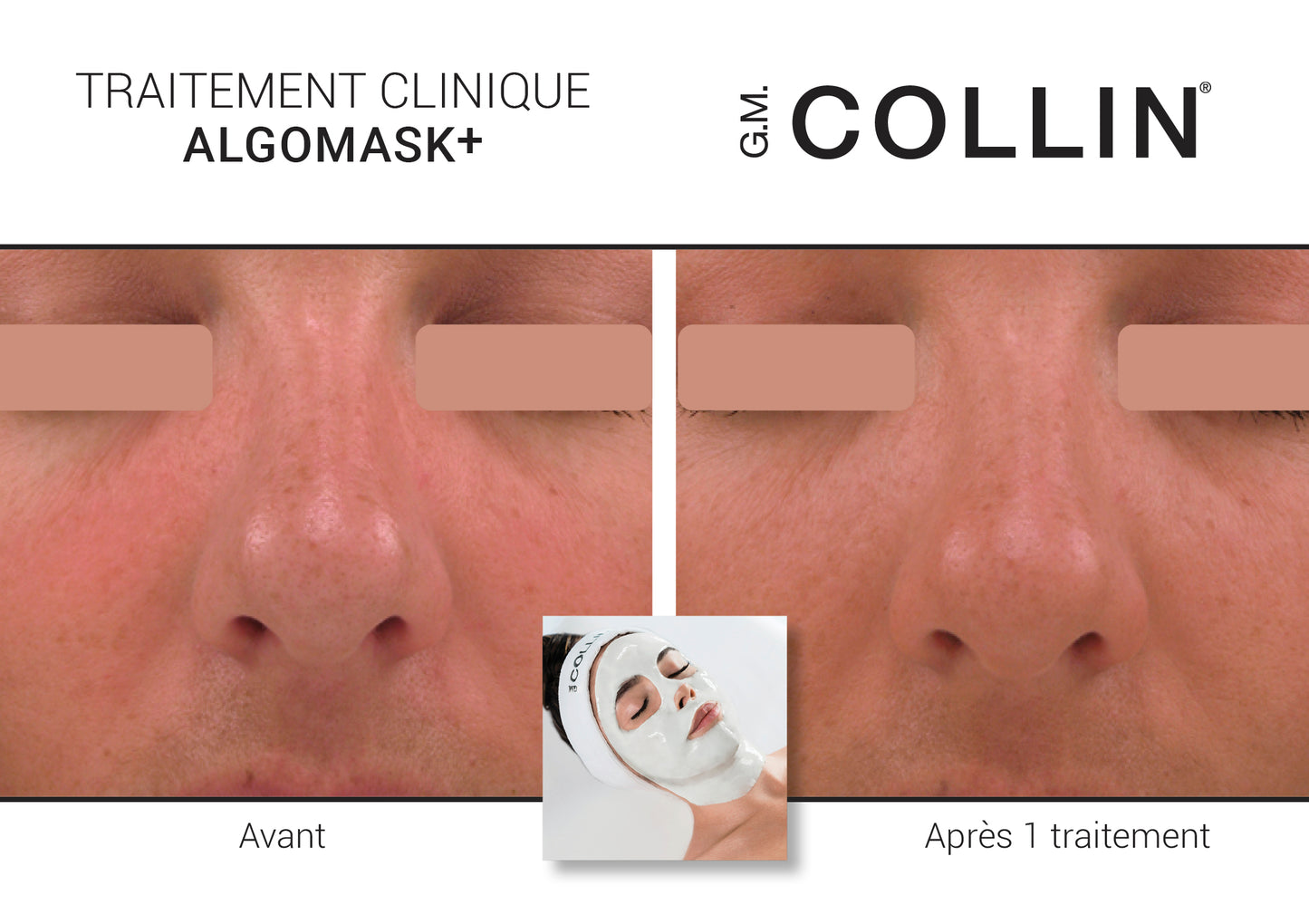 Soin Algomask+ - G.M. Collin