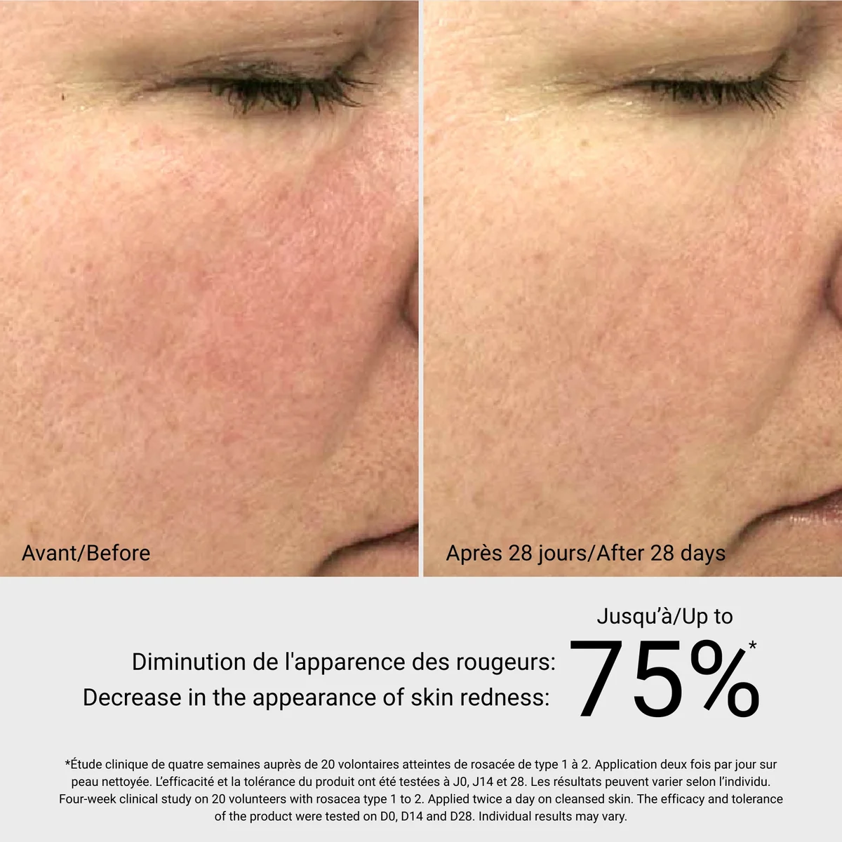 Rosa Sea Gel G.M. Collin - résultat avant après 28 jours, diminution des rougeurs jusqu'à 75% - Spa Santé Le Nénuphar