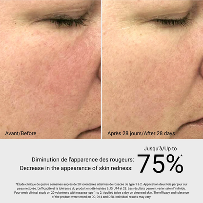 Rosa Sea Gel G.M. Collin - résultat avant après 28 jours, diminution des rougeurs jusqu'à 75% - Spa Santé Le Nénuphar