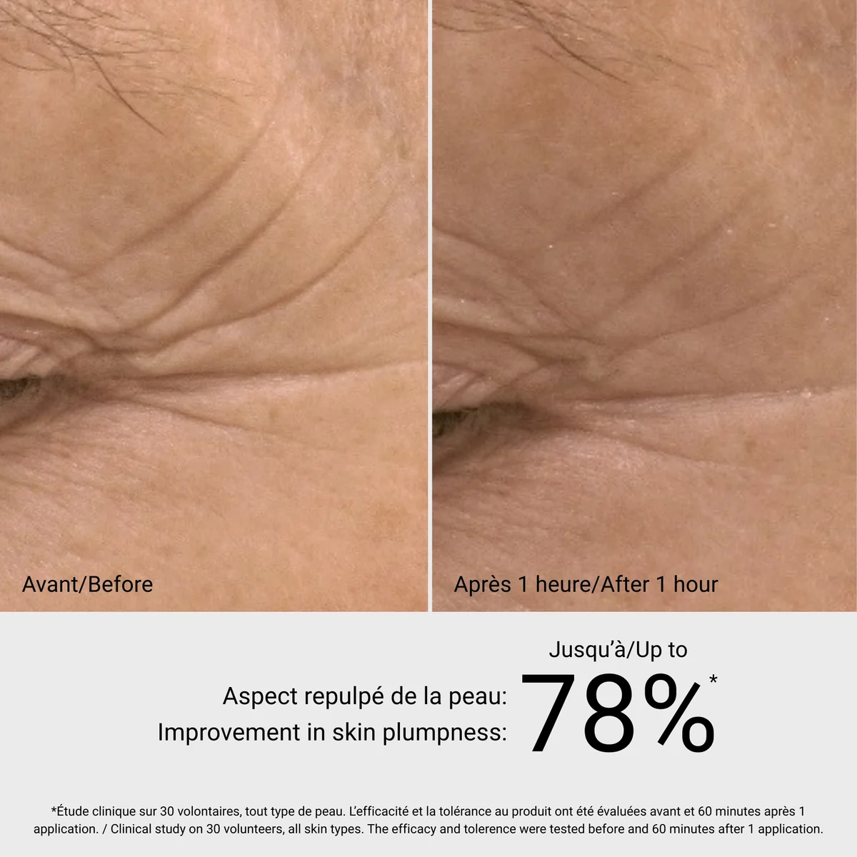Hyaluronic Sérum G.M. Collin - résultat avant après 1 heure, amélioration repulpage peau jusqu'à 78% - Spa Santé Le Nénuphar