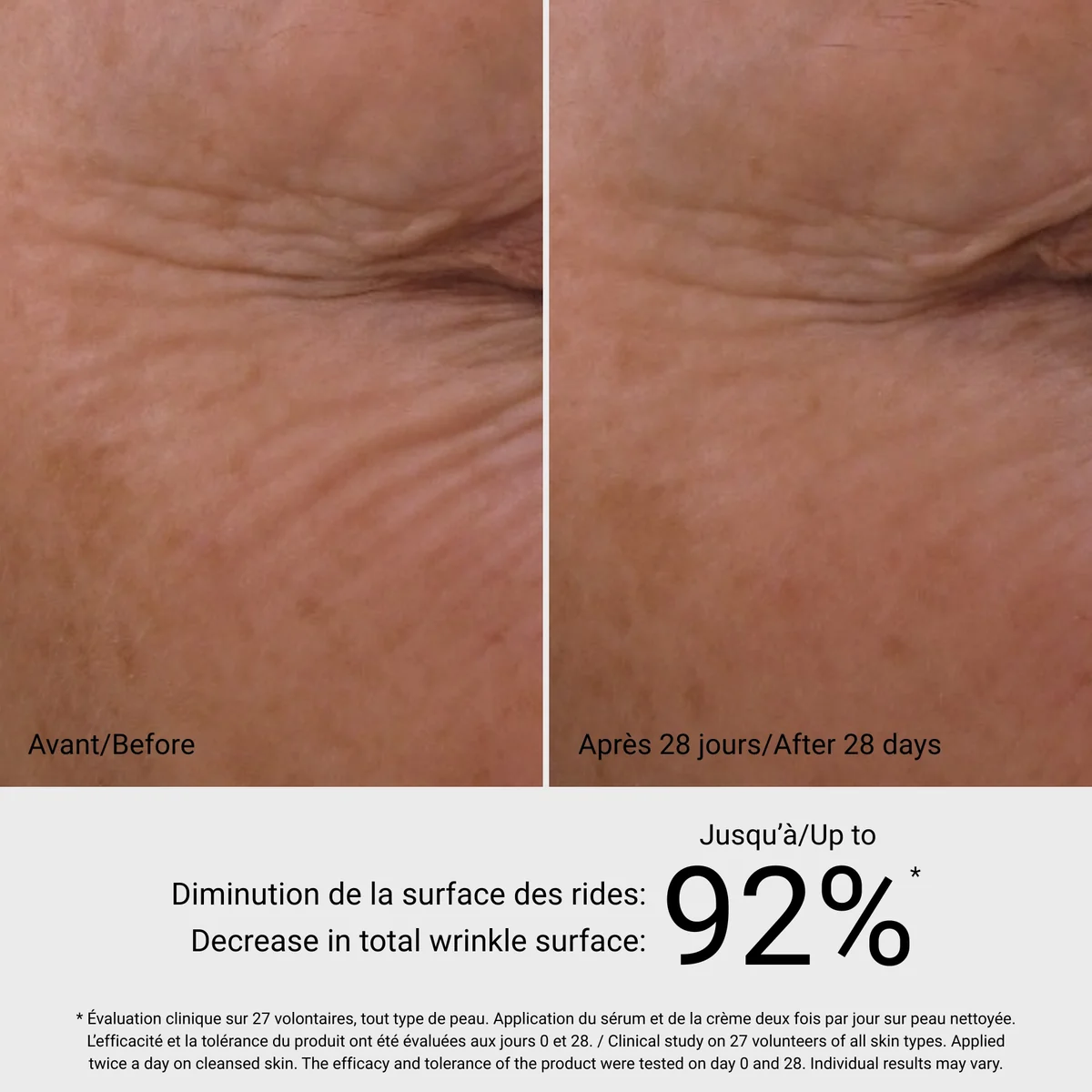 Diamond Crème G.M. Collin - résultat avant après 28 jours, diminution des rides jusqu'à 92% - Spa Santé Le Nénuphar