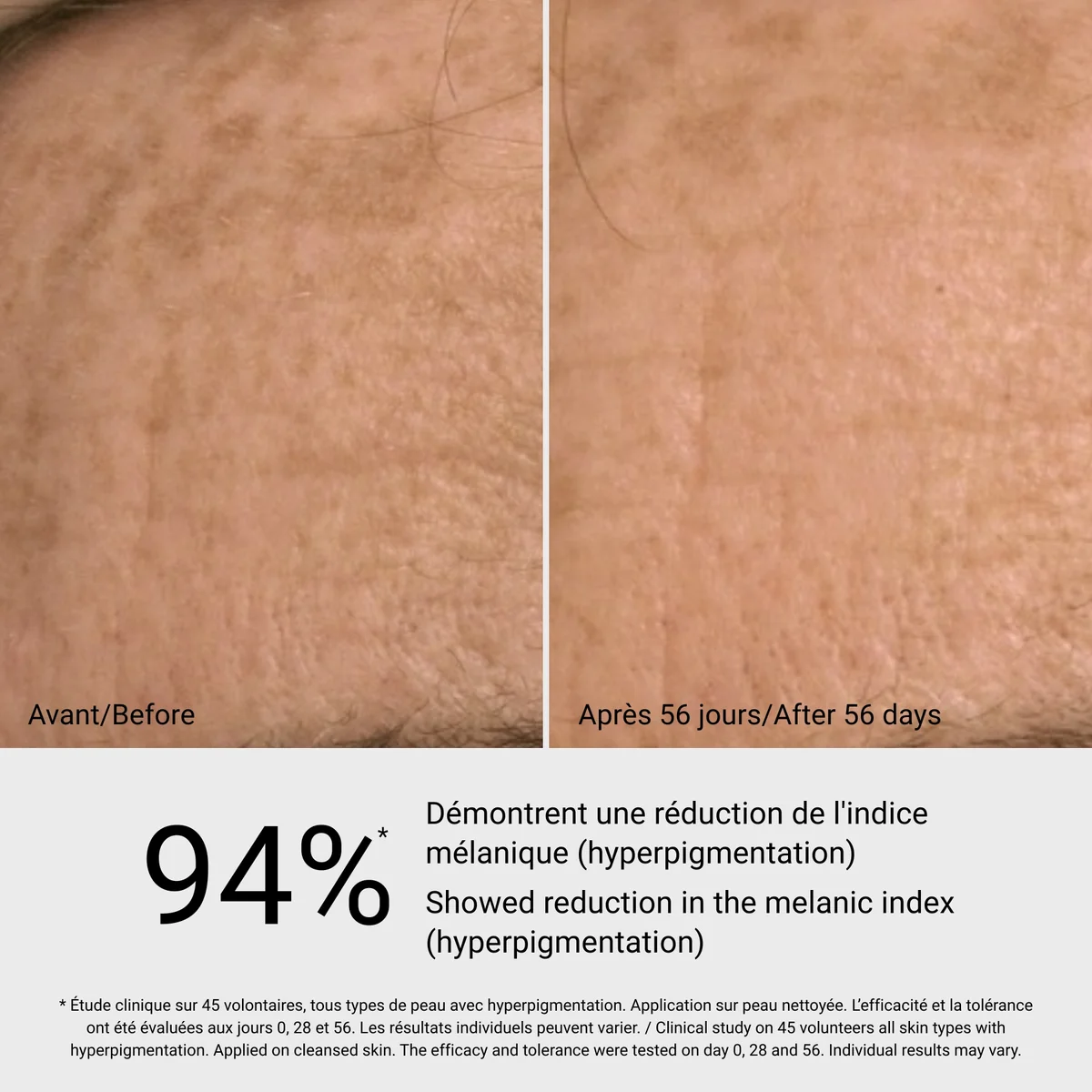 Sérum anti-taches G.M. Collin - résultat avant après 56 jours, 94% réduction hyperpigmentation - Spa Santé Le Nénuphar