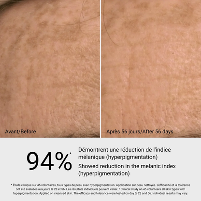 Sérum anti-taches G.M. Collin - résultat avant après 56 jours, 94% réduction hyperpigmentation - Spa Santé Le Nénuphar